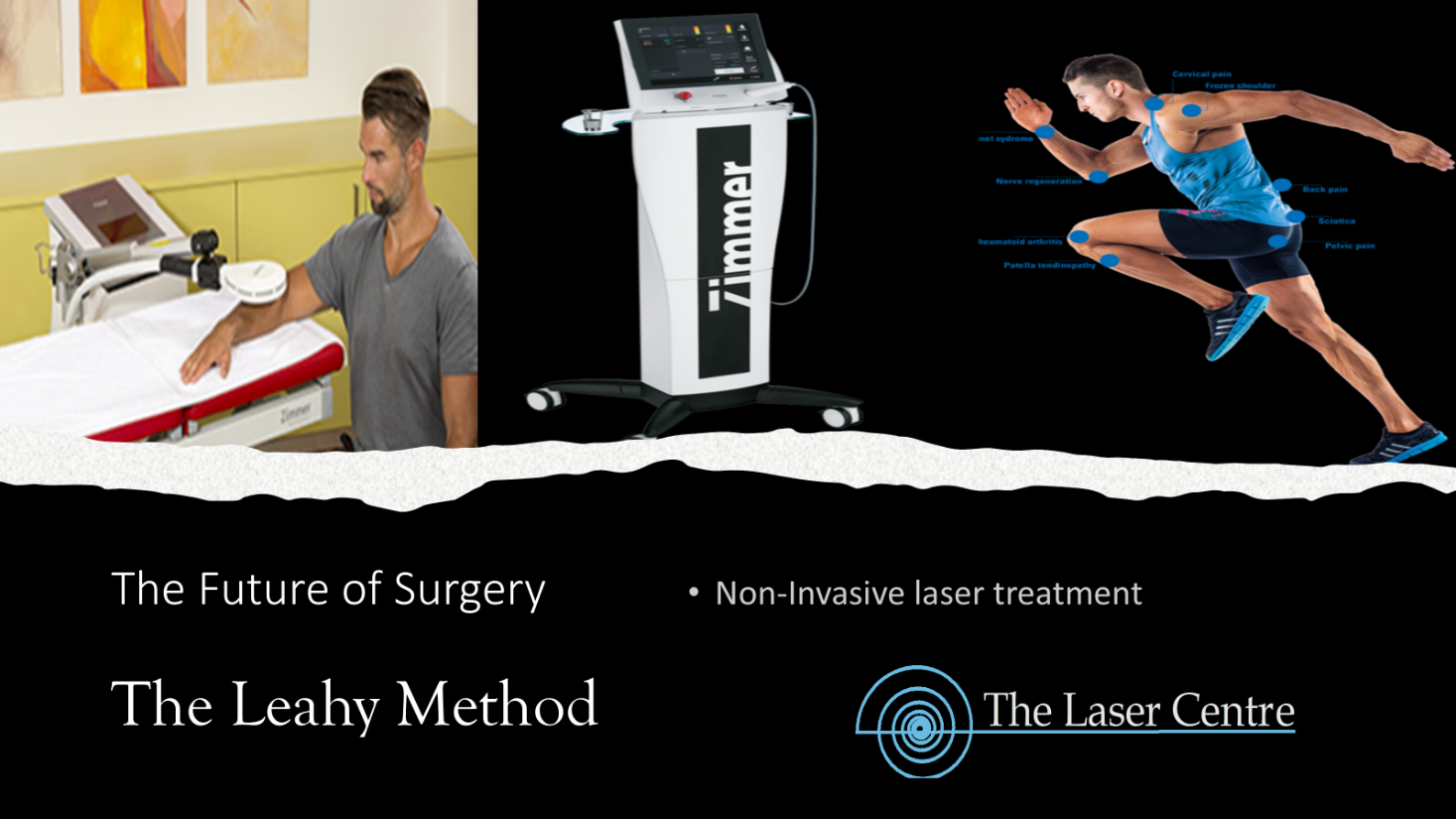 Back injury - The Laser Centre Back injury